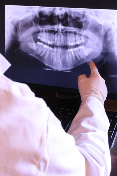 Best Broken or Cracked Tooth Emergency Dentist in Hancock, MD